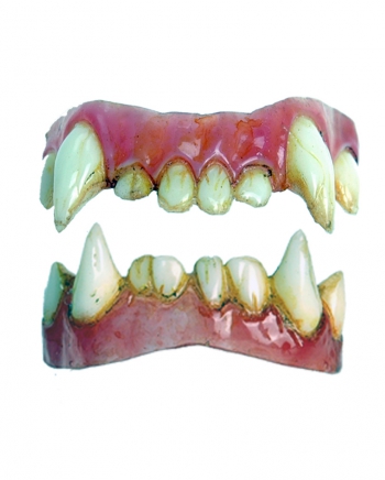 Dental FX Veneers Werwolf-Zähne